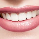 Tooth Whitening Dentist Office