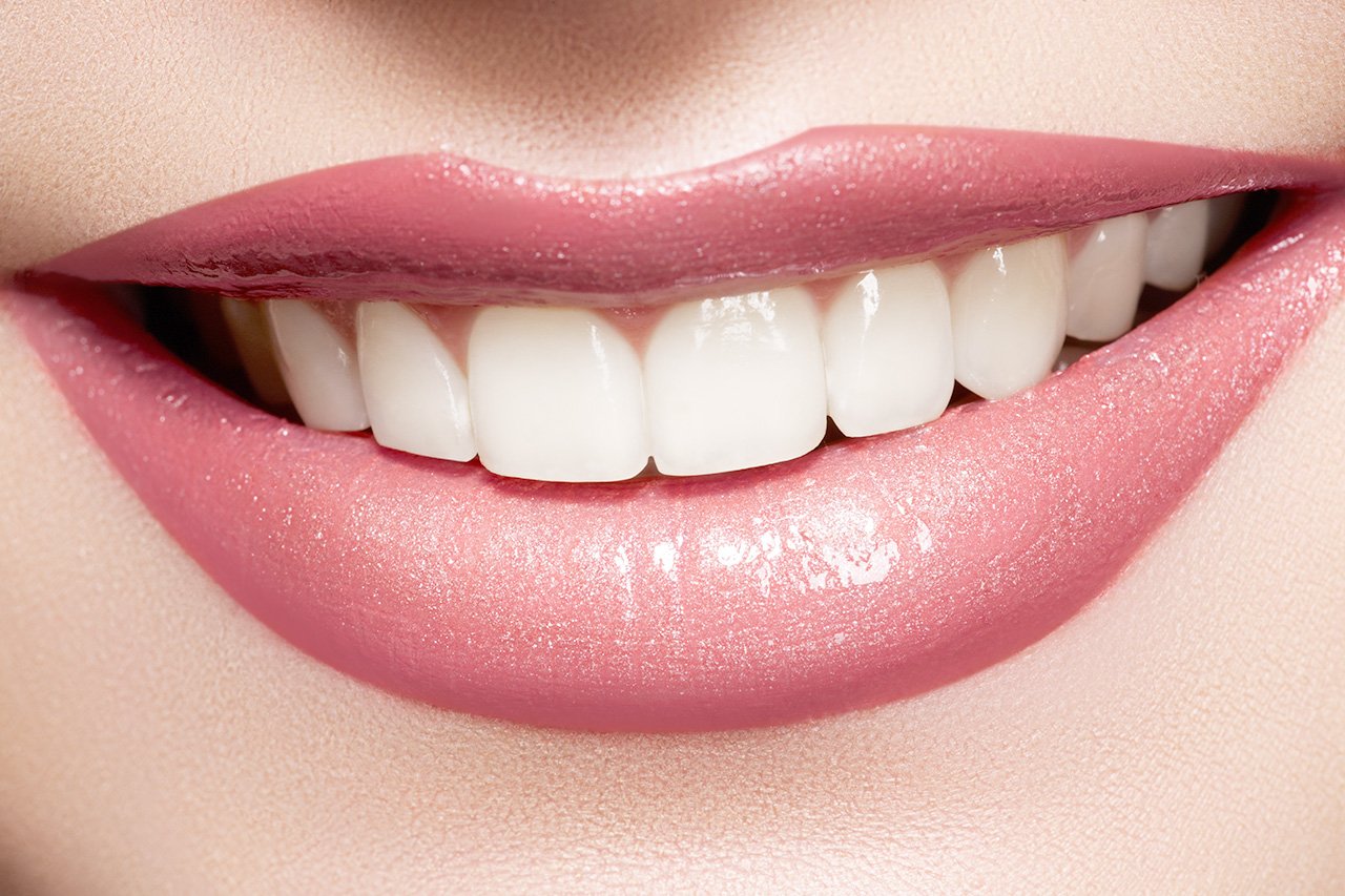 Tooth Whitening Dentist Office