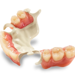 Important Considerations about Wearing Dentures