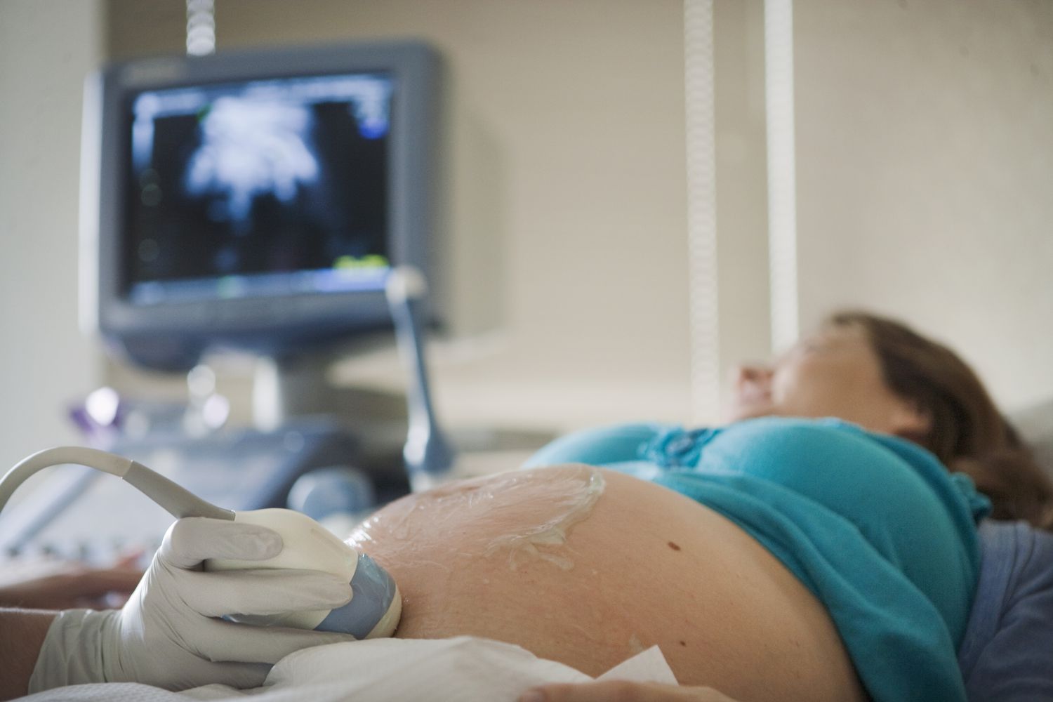 Understanding the Nuchal Translucency Test: A Comprehensive Guide