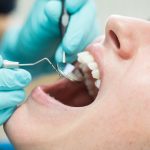 How Can Smoking Cause Dental Emergencies?